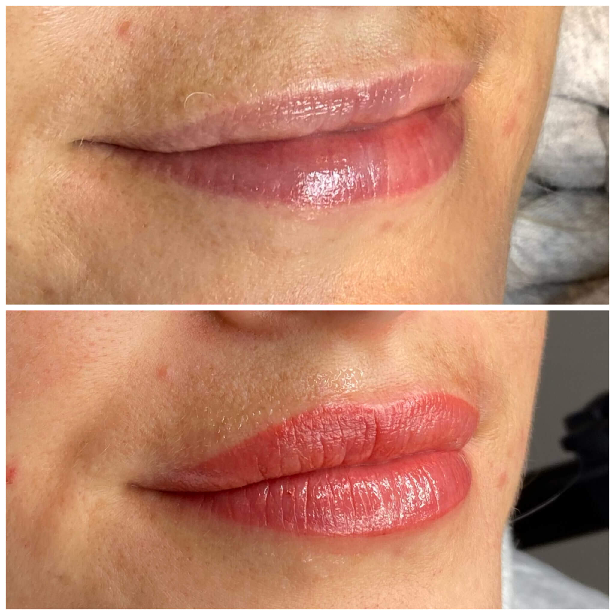 Vorher-Nachher-Vergleich der Lippen nach Permanent Make-up für mehr optische Fülle